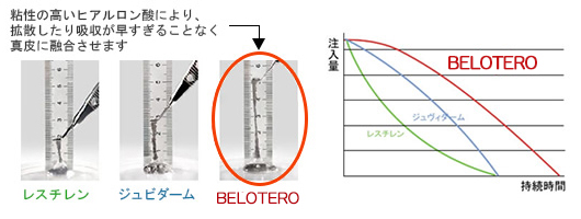 ヒアルロン酸BELOTEROの持続時間の比較